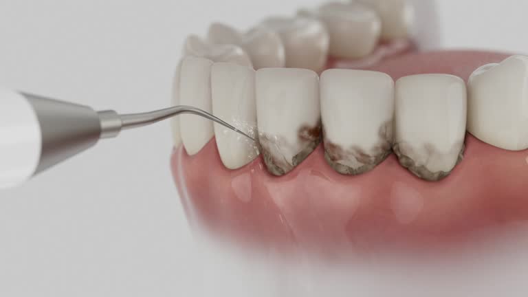 Reliable Tooth Extraction contractor in Garrett, TX by Smile Center Dentistry